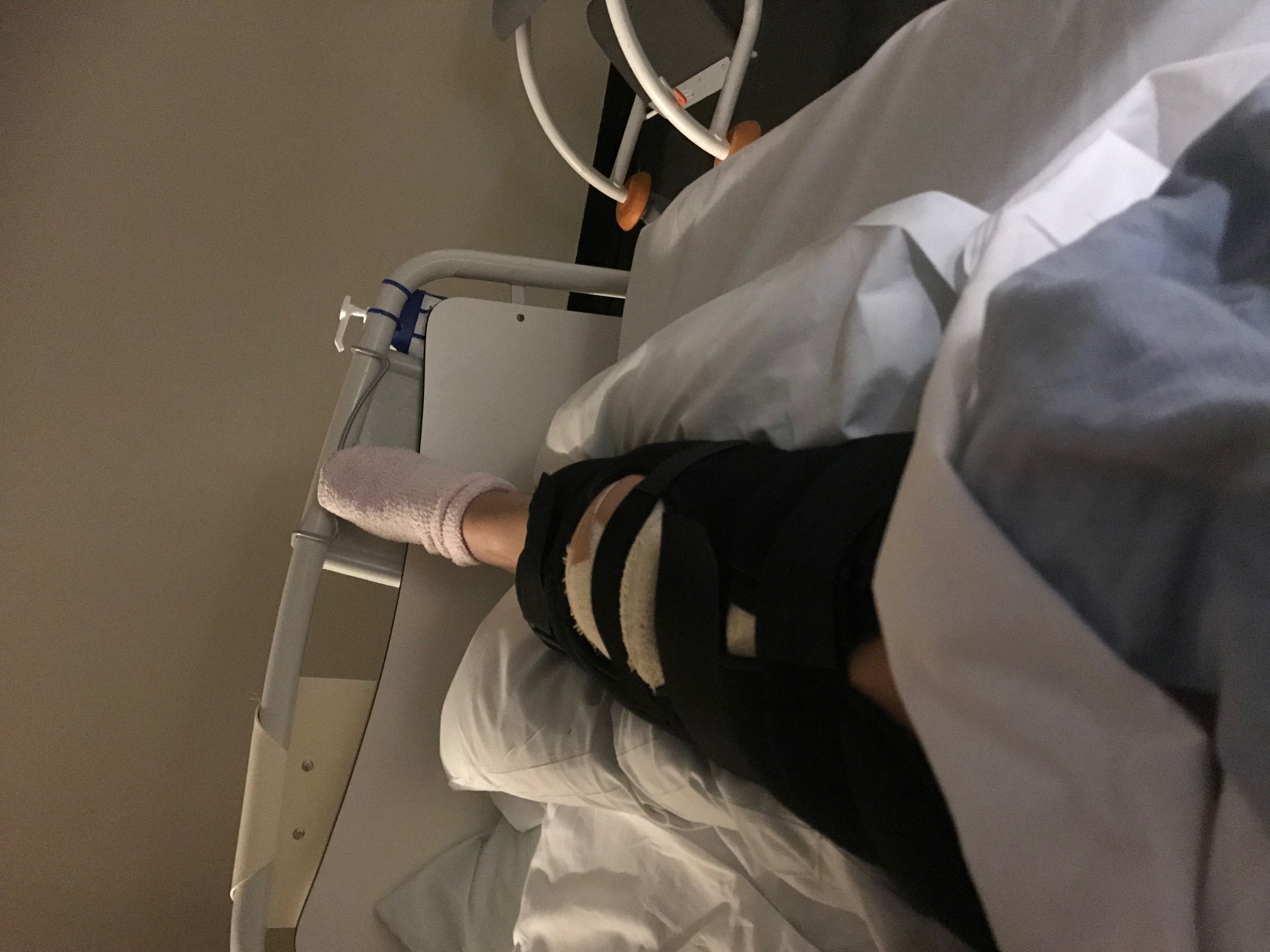 case study fractured leg