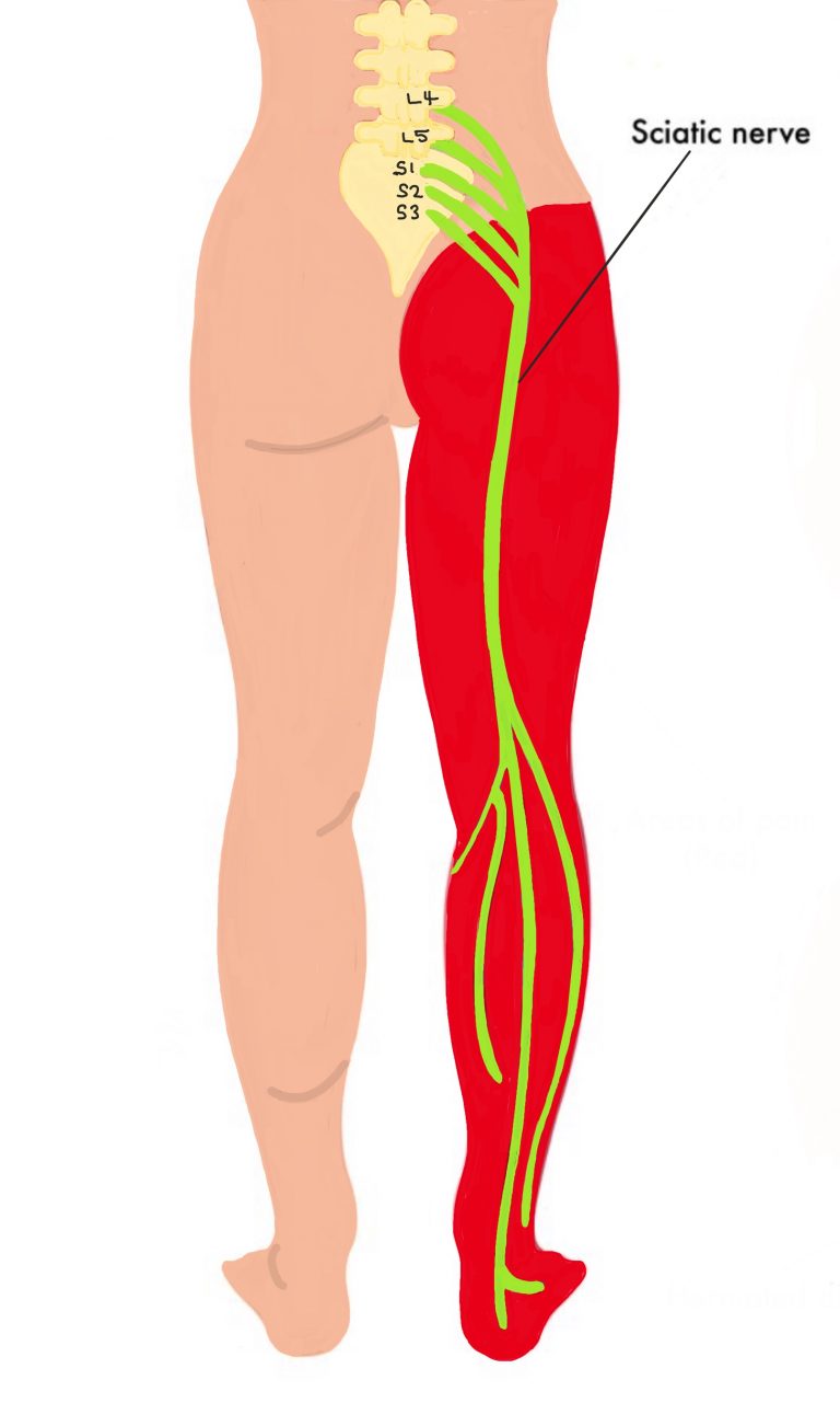 Sciatic Nerve Dermatome The Iveson Clinic For Physiotherapy And Chiropractic